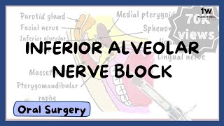 Inferior Alveolar Nerve Block Technique [upl. by Roose]