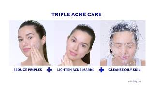 Triple Acne Care with Céleteque Acne Cleansing Stick See results in as early as 7 days [upl. by Retsevlis635]