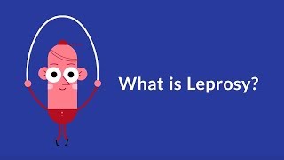 What is Leprosy Chronic Infectious Disease [upl. by Ardnaik]