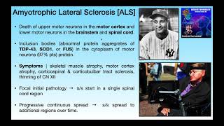 Amyotrophic Lateral Sclerosis ALS  Basics amp Clinical Presentation [upl. by Veal]