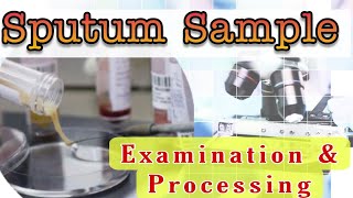 Sputum Sample Examination amp Processing [upl. by Steck]