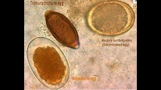 parasites seen from the microscope [upl. by Wohlert221]