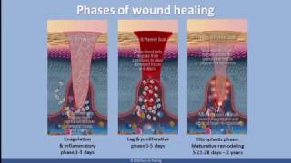 Understanding Scar Tissue [upl. by Rudyard]