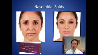 Whats the Best Filler for Smile Lines  Nasolabial Folds Consultation  Dr Anthony Youn [upl. by Ainoyek]