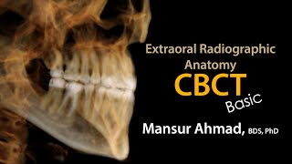 Basic CBCT ConeBeam CT Anatomy [upl. by Orvil]