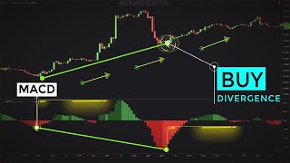 Trading MACD Divergences Like Professional Traders Forex amp Stocks Strategy [upl. by Septima]