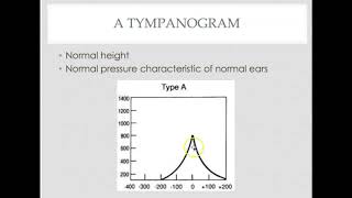 Tympanometry interpretation [upl. by Yasmeen493]