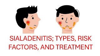 Understanding Sialadenitis Types Acute and Chronic Risk Factors and Treatment Options [upl. by Alilahk]