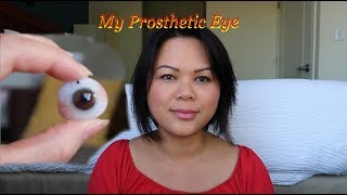 My Prosthetic Eye [upl. by Balthasar]