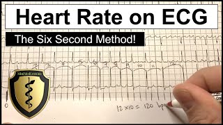 ECG Heart Rate Calculation  The Six Second Method [upl. by Jari]