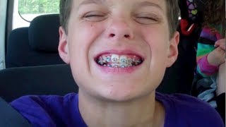 Caleb Gets Braces WK 1213 [upl. by Bullis]