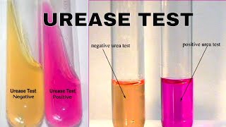 Urea Hydrolysis Urease Test [upl. by Prem]