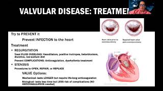 Complex Valvular Heart Disease [upl. by Zeke656]