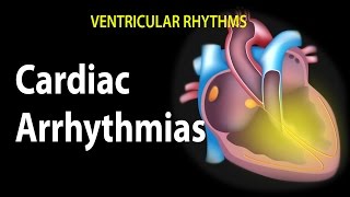 Cardiac Arrhythmias Animation [upl. by Hatfield129]