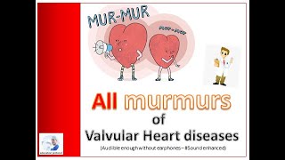 Murmurs of Valvular Heart Diseases Sound enhanced [upl. by Pergrim]