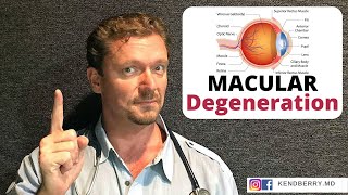 MACULAR Degeneration Prevent It  Improve It 2024 [upl. by Serg]