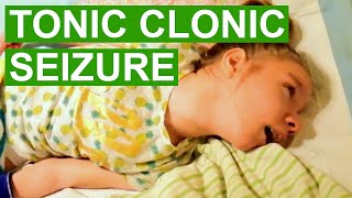 Tonic Clonic Seizure Video [upl. by Yelsnya691]