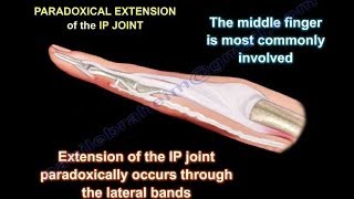 How to Get Rid of Swelling in Fingers [upl. by Bart]