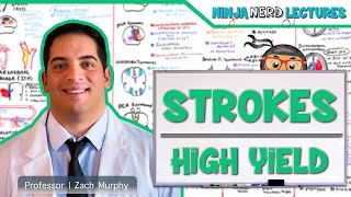 Ischemic and Hemorrhagic Strokes  High Yield [upl. by Ayhtin]