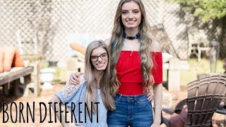 My Identical Twin With Dwarfism  BORN DIFFERENT [upl. by Territus928]