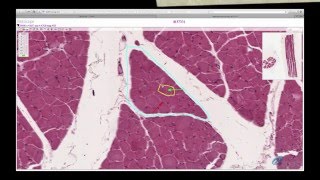 Histology Helper  Muscle Histology [upl. by Immak350]