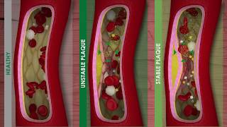 Circulatory System  Coronary Circulation [upl. by Victoria]