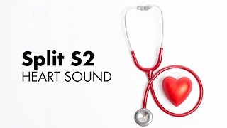 Fixed Split S2  Heart Sounds  MEDZCOOL [upl. by Naloj]