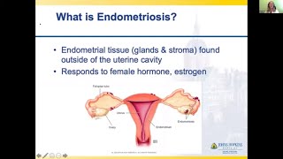 Pelvic inflammatory disease  causes symptoms diagnosis treatment pathology [upl. by Suolkcin]