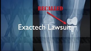 Can You Sue For Bad Knee Replacement  Exactech Knee Lawsuit [upl. by Kwapong]