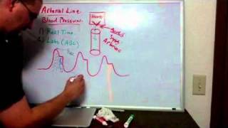 Haemodynamics Part 6 Arterial Line [upl. by Woll]