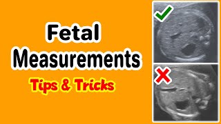 Fetal Circulation FUN SIMPLE and MEMORABLE [upl. by Sybille]