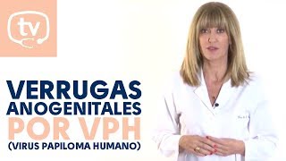 Verrugas anogenitales por el VPH Virus Papiloma Humano [upl. by Lilah778]