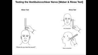 Interpreting the WeberRinne Tests EXPLAINED [upl. by Julie]