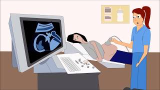 PreEclampsia  CRASH Medical Review Series [upl. by Ahtikal]