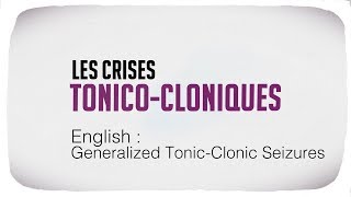 Generalized Tonic Clonic Seizures [upl. by Effy]