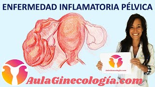 Pubalgia Ejercicios y consejos de fisioterapia para su tratamiento [upl. by Hanafee607]