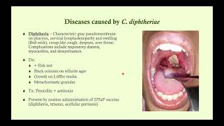 Corynebacterium diphtheriae Diphtheria  Microbiology Boot Camp [upl. by Methuselah593]