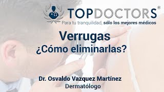 ¿Cómo eliminar las verrugas  Tratamientos [upl. by Darill681]