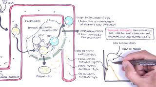 Epstein Barr Virus and Infectious Mononucleosis pathophysiology investigations and treatment [upl. by Sidras]