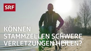 Stammzellen Ein Wundermittel der Medizin  Erklärvideo  SRF [upl. by Nelle]