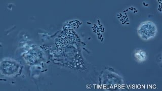 Bacterial phagocytosis by macrophage マクロファージによる細菌の貪食 [upl. by Inasah]