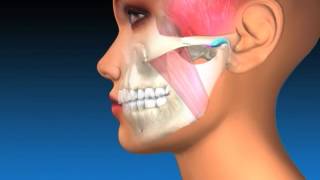 TMJ Explanation amp Therapy [upl. by Adnylem]