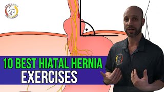 10 Best HIATAL HERNIA Exercises [upl. by Freeland]