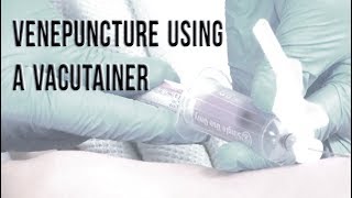 Venepuncture Using a Vacutainer [upl. by Mikol]