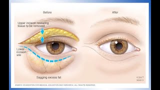 1 Natural Way to Stop EYE TWITCHING  Dr Stephen Cabral [upl. by Onairda116]