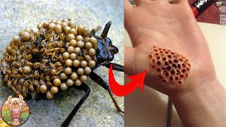 Les Insectes Les Plus Dangereux Au Monde [upl. by Alithea]