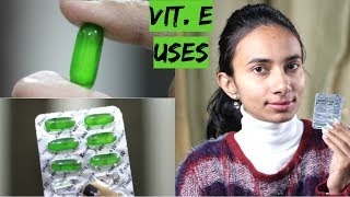 7 Vitamin E Oil Capsule Evion 400 Uses for Skin  Face and Hair [upl. by Eisej548]