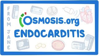 Clinicians Corner Endocarditis [upl. by Ky]