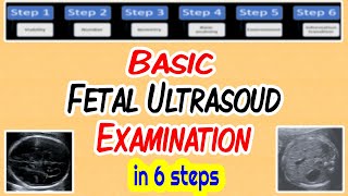 Basic Fetal Ultrasound Examination [upl. by Heydon]