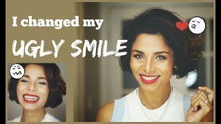 How to IMPROVE AWKWARD SMILE into PICTURE PERFECT Smile Without Dentist GIVEAWAY [upl. by Adnanref]